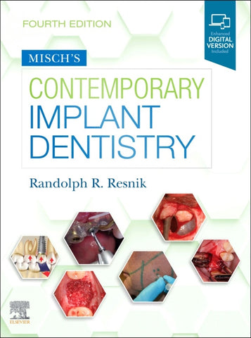 Misch's Contemporary Implant Dentistry E-Book (ebook)