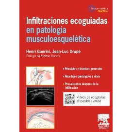 INFILTRACIONES ECOGUIADAS EN PATOLOGIA MUSCULOESQU-UB-2017-UNIVERSAL BOOKS-UNIVERSAL BOOKS