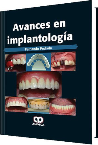 Avances en Implantología-UNIVERSAL BOOKS-UNIVERSAL BOOKS