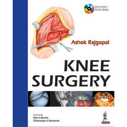 KNEE SURGERY -Rajgopal-jayppe-UNIVERSAL BOOKS