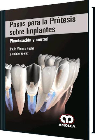 Pasos para la Prótesis sobre Implantes – Planificación y control-UNIVERSAL BOOKS-UNIVERSAL BOOKS