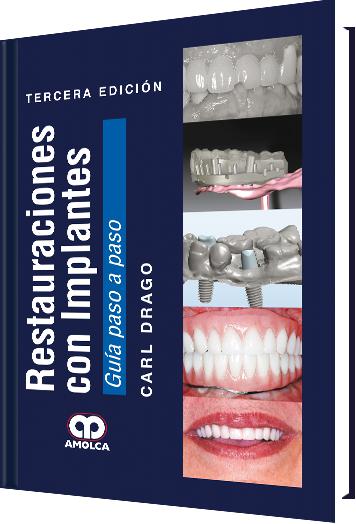 Restauraciones con Implantes Guía paso a paso-UNIVERSAL BOOKS-UNIVERSAL BOOKS