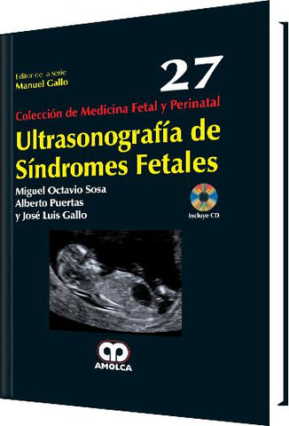 Ultrasonografía de Síndromes Fetales-UNIVERSAL BOOKS-UNIVERSAL BOOKS