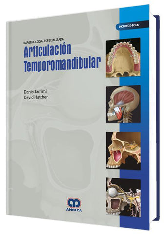 IMAGENOLOGIA ESPECIALIZADA ARTICULACION TEMPOROMANDIBULAR-UNIVERSAL BOOKS-UNIVERSAL BOOKS