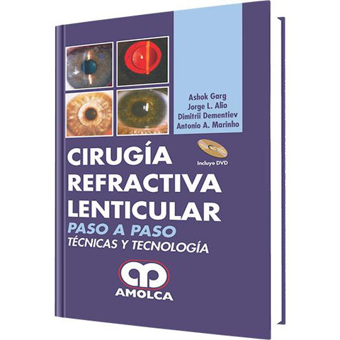 Cirugia Refractiva Lenticular PASO A PASO Tecnicas y Tecnologia-REVISION - 24/01-amolca-UNIVERSAL BOOKS