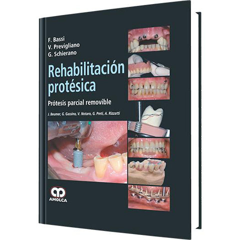 Rehabilitacion Protesica en Protesis parcial Removible-REVISION - 27/01-amolca-UNIVERSAL BOOKS