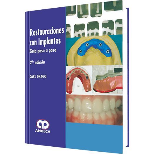 Restauracion con Implantes - Guia Paso a Paso-REVISION - 26/01-amolca-UNIVERSAL BOOKS