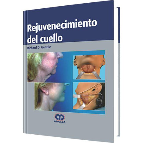 Rejuvenecimiento del Cuello-amolca-UNIVERSAL BOOKS