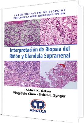 INTERPRETACION DE BIOPSIAS. INTERPRETACION DE BIOPSIA DEL RIÑON Y GLANDULA SUPRARENAL-UNIVERSAL BOOKS-UNIVERSAL BOOKS