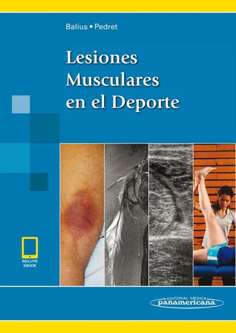 Lesiones Musculares en el Deporte