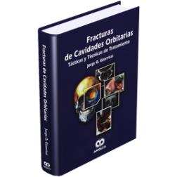 Fracturas de Cavidades Orbitarias-amolca-UNIVERSAL BOOKS