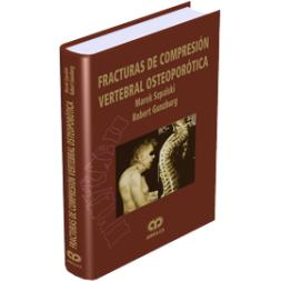 Fracturas de Compresion Vertebral-amolca-UNIVERSAL BOOKS