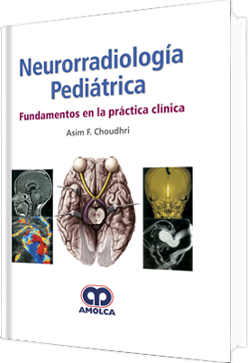 NEURORRADIOLOGIA PEDIATRICA-UNIVERSAL BOOKS-UNIVERSAL BOOKS