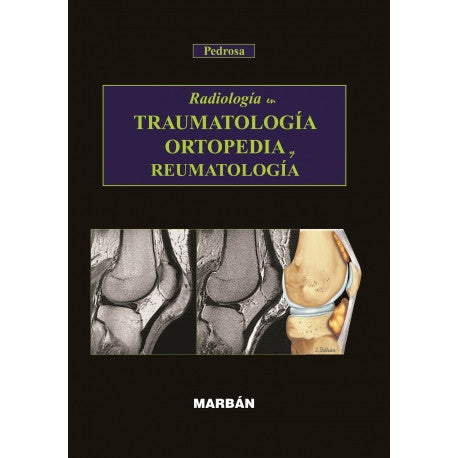 RADIOLOGIA en TRAUMAT. ORTOP. y REUMAT-REVISION - 27/01-MARBAN-UNIVERSAL BOOKS