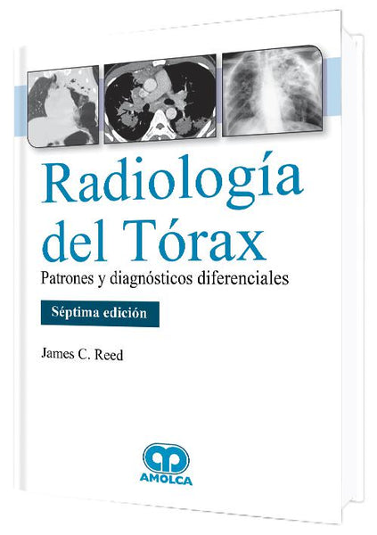 RADIOLOGIA DEL TORAX-UNIVERSAL BOOKS-UNIVERSAL BOOKS