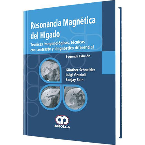 Resonancia Magnetica del Higado-REVISION - 26/01-amolca-UNIVERSAL BOOKS